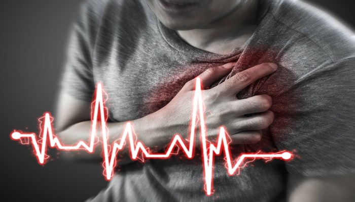 Cardiac Arrest